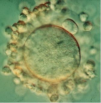Mature oocyte, ready for fertilization; surrounding the oocyte are follicle cells